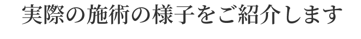 実際の施術の様子をご紹介します